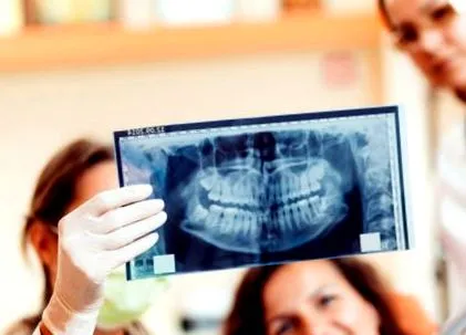 radiografiile