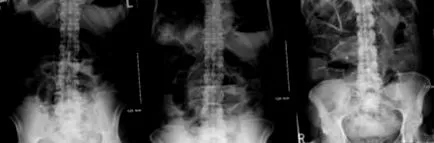 gastrointestinalis