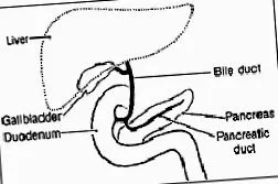 pancreatită