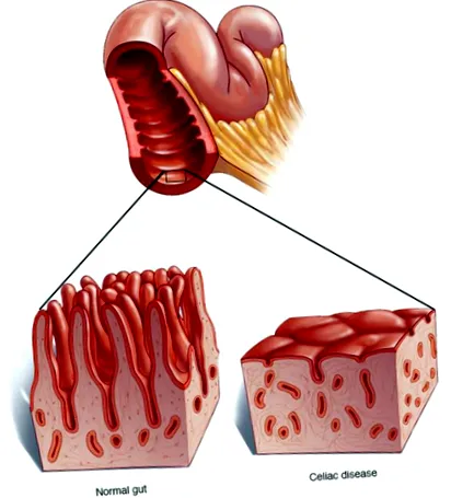dieta