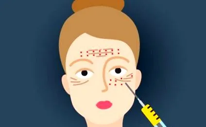 накара