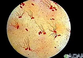 enteritis
