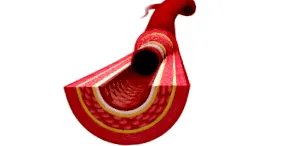 vasculară