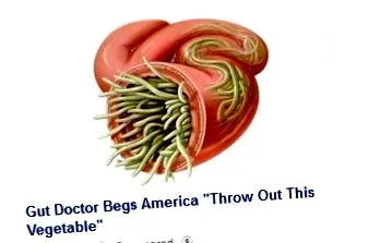 intestinal