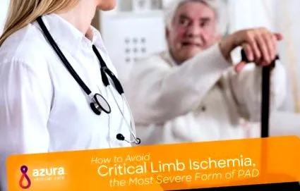 крайниците исхемия