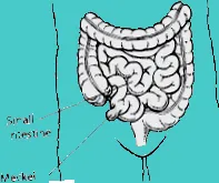 diverticulum