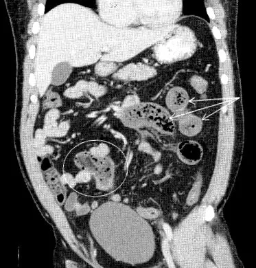 laparoscopic