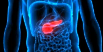 pancreatita