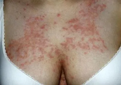 след