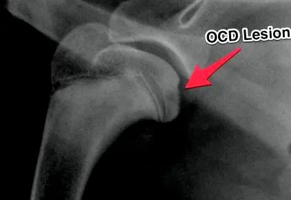 disecă