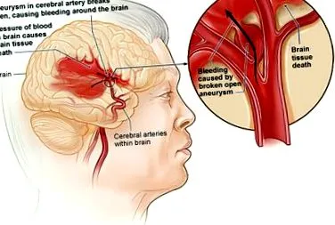physiopedia