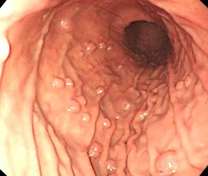 какво