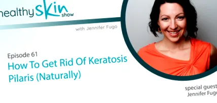 Keratosis Pilaris