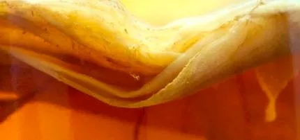 kombucha