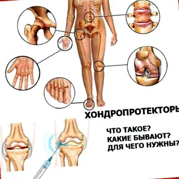 става остеоартрит