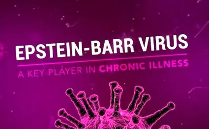 Epstein Barr