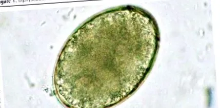 Diphyllobothrium latum