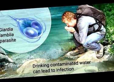 giardia