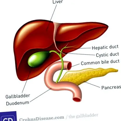 crohn