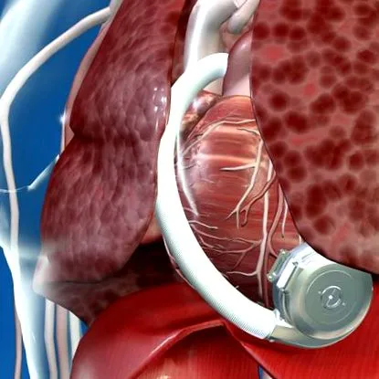 ucsf здраве