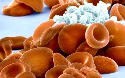 ScienceDirect теми кръвни съсиреци