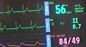 health медът