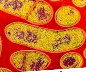 botulism