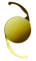 cataractă