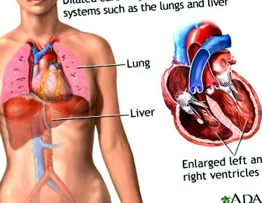 medlineplus medlineplus