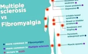 fibromyalgia