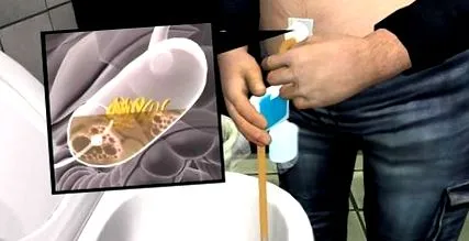 dispozitivul