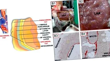 infiltrarea