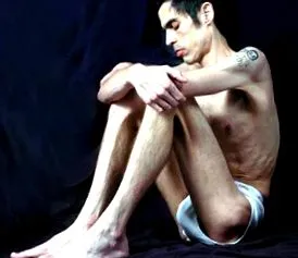 anorexia