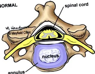cervical