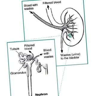 nephropathia