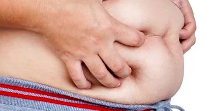 abdominală