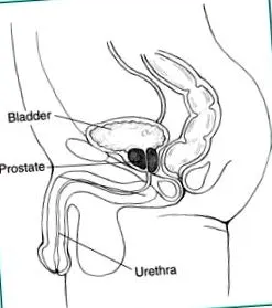 prostată