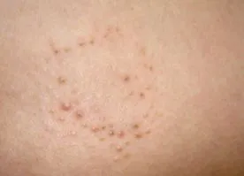 dermnet