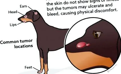 myeloma