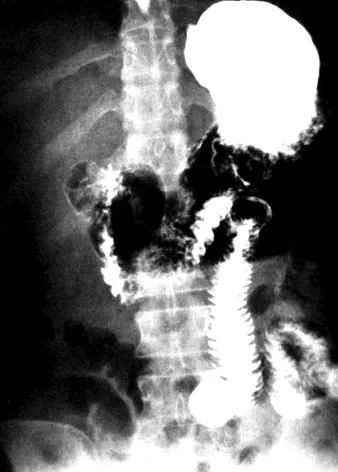 fundus mirigy
