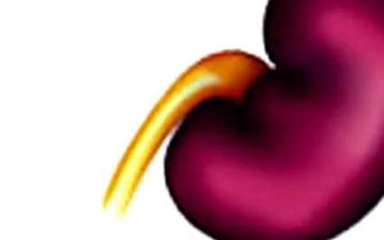 trombocitopenie