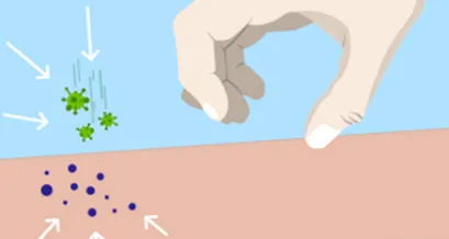 atópiás dermatitis