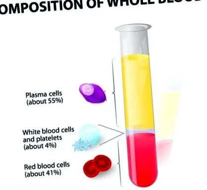 anemia