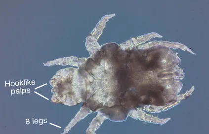 mites