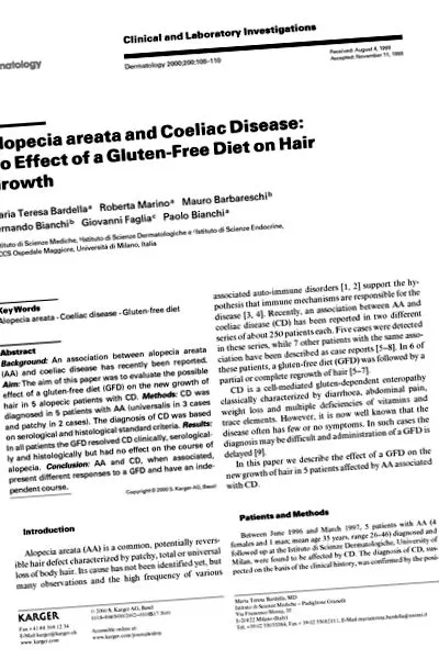 alopecia
