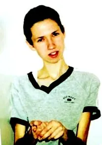 anorexia