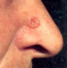 bazocelular