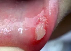 dermnet