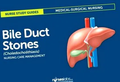 choledocholithiasis