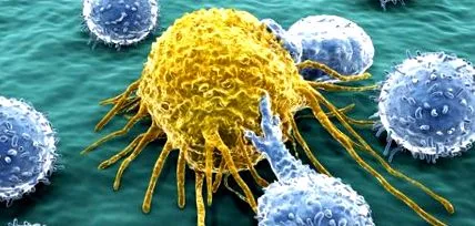 cancerului